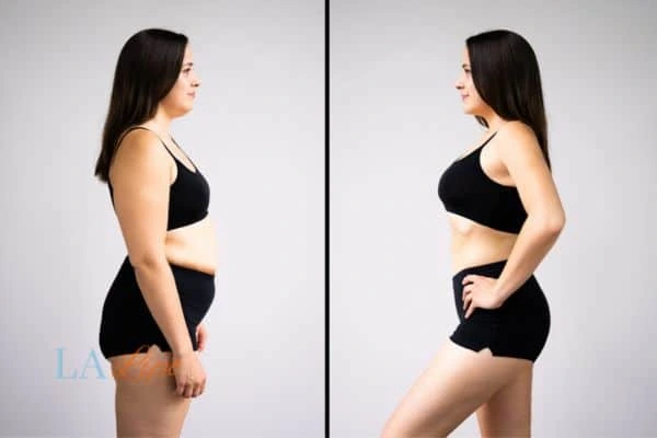 LA-EMS Body Sculpting Chalk Farm results before and after of womans results on body toning.