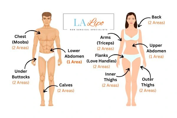 LA LIPO Cryolipolysis Areas Chalk Farm
