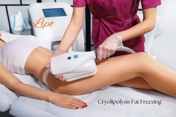 Woman receiving coolsculpting Chalk Farm treatment on her thighs