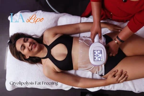 woman getting cryolipolysis Chalk Farm
