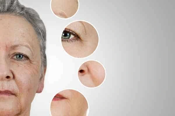 HIFU Facelift Chalk Farm from LA LIPO
