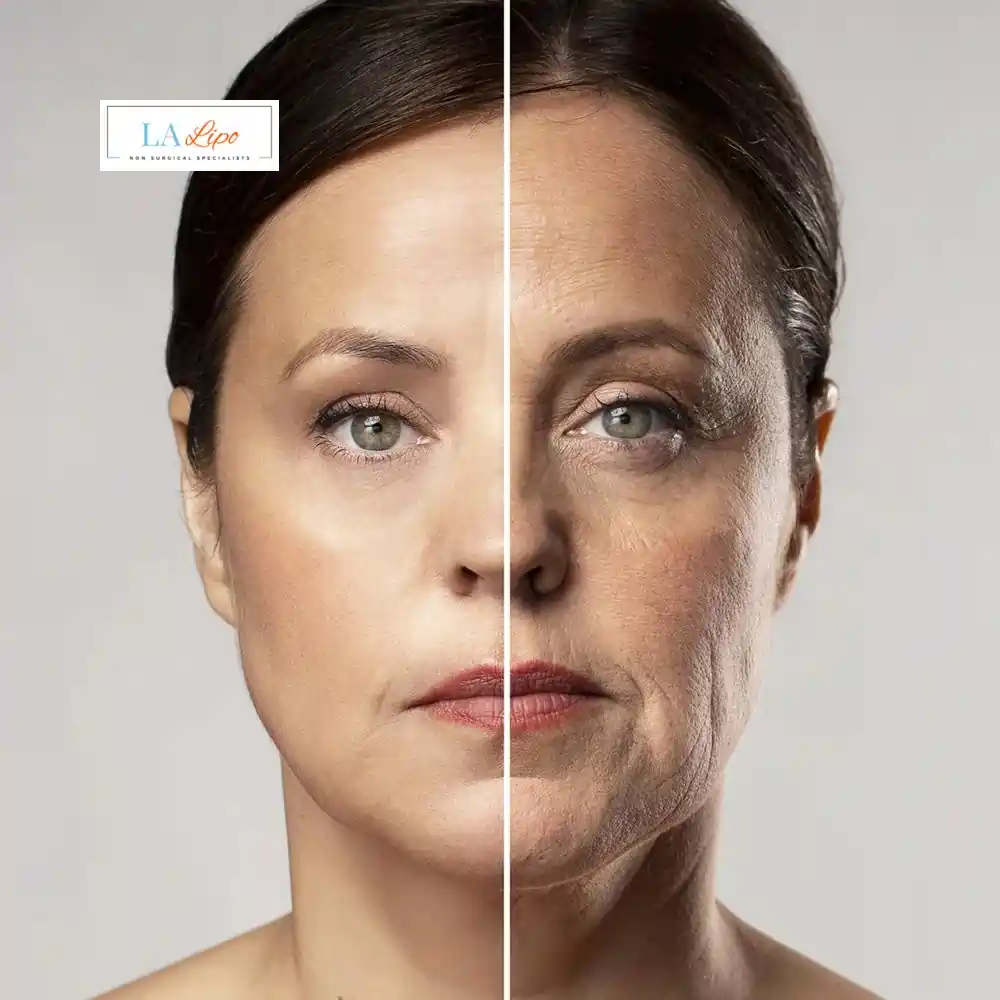 How Can You Tell If Non-Surgical Skin Tightening Is Right for You Chalk Farm?